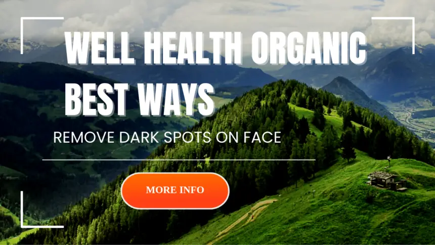 Well Health Organic Best Ways to Remove Dark Spots on Face